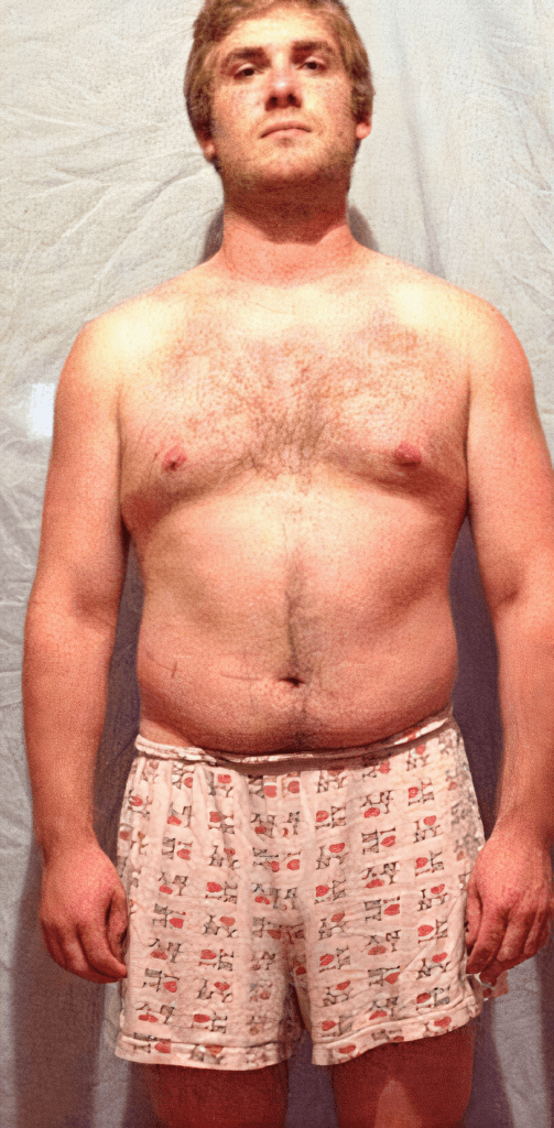 athlete belly fat before using anavar steroid